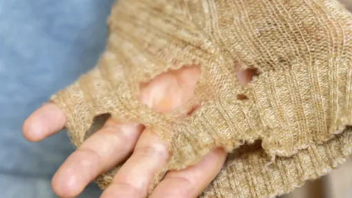 A hand poking through a hole in a jumper